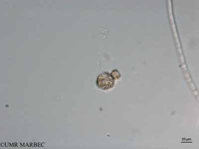phyto/Brazilian_Nordeste/Seamounts_station60/ABRACOS2 April 2017/Scyphosphaera apsteinii (Snap-592)(copy)_thumb.jpg